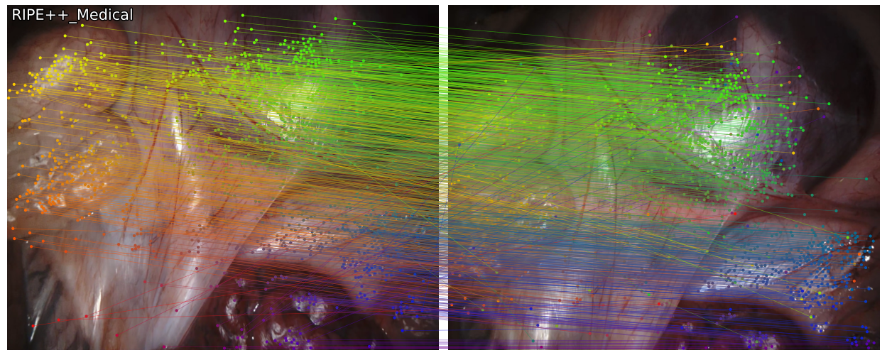 RIPE++ Medical raw matches on a SCARED1500 endoscopic image pair.